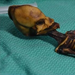 Researchers finally solve mystery of 'alien' skeleton