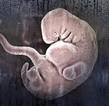 Pro-life org doesn't buy survey showing that young Americans, college grads tend to favor abortion
